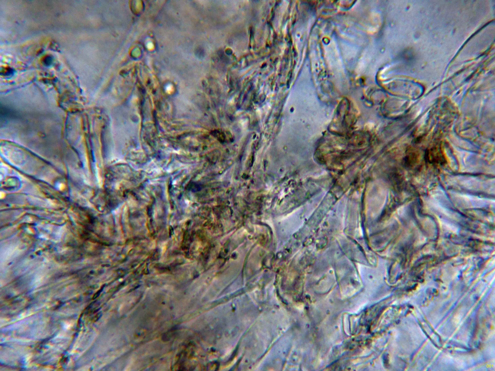 Microscopía de Lyophyllum eucalypticum - 10 - Subpellis agua-001